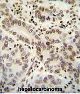 HIST1H2B Antibody (Center) western blot analysis in CEM,HL-60,NCI-H460 cell line lysates (35ug/lane).This demonstrates the HIST1H2B antibody detected the HIST1H2B protein (arrow).