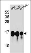 HIST1H2B Antibody (Center) western blot analysis in CEM,HL-60,NCI-H460 cell line lysates (35ug/lane).This demonstrates the HIST1H2B antibody detected the HIST1H2B protein (arrow).
