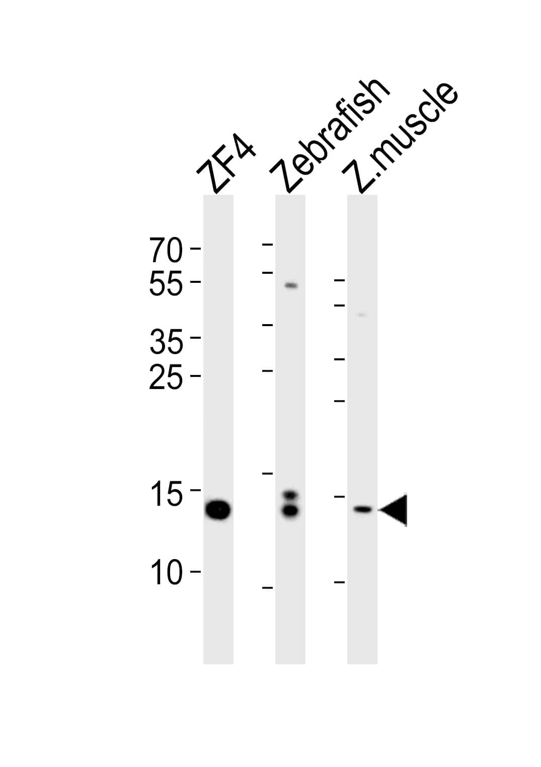 HIST1H2B Antibody (Center) western blot analysis in CEM,HL-60,NCI-H460 cell line lysates (35ug/lane).This demonstrates the HIST1H2B antibody detected the HIST1H2B protein (arrow).