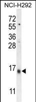 Western Blot Ly-6G6C Antibody (RB27560)