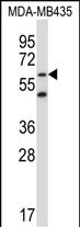 ZNF479 Antibody (N-term) western blot analysis in MDA-MB435 cell line lysates (35ug/lane).This demonstrates the ZNF479 antibody detected the ZNF479 protein (arrow).
