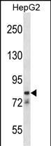 Western Blot CATSPER1 Antibody (RB32588)