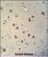 Immunohistochemistry-Paraffin Tectorin Beta Antibody (RB27701)