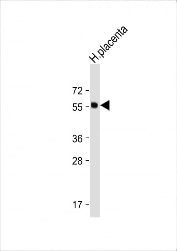 Western Blot Isthmin 1/ISM1 Antibody (RB25991)