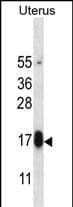 GPHB5 Antibody (C-term) western blot analysis in human normal Uterus tissue lysates (35ug/lane).This demonstrates the GPHB5 antibody detected the GPHB5 protein (arrow).