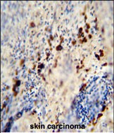 LCE1A Antibody (C-term) western blot analysis in T47D cell line lysates (35ug/lane).This demonstrates the LCE1A antibody detected the LCE1A protein (arrow).