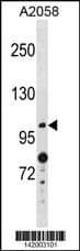 ANO4 Antibody (N-term) western blot analysis in A2058 cell line lysates (35ug/lane).This demonstrates the ANO4 antibody detected the ANO4 protein (arrow).