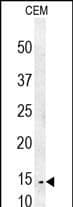Western Blot CRCT1 Antibody (RB27599)