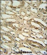 Immunohistochemistry-Paraffin GGTLC2 Antibody (RB24615)
