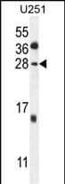 Western Blot GGTLC2 Antibody (RB24615)