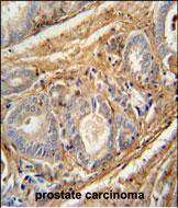Immunohistochemistry-Paraffin PCOTH Antibody (RB28580)