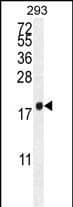Western Blot PCOTH Antibody (RB28580)