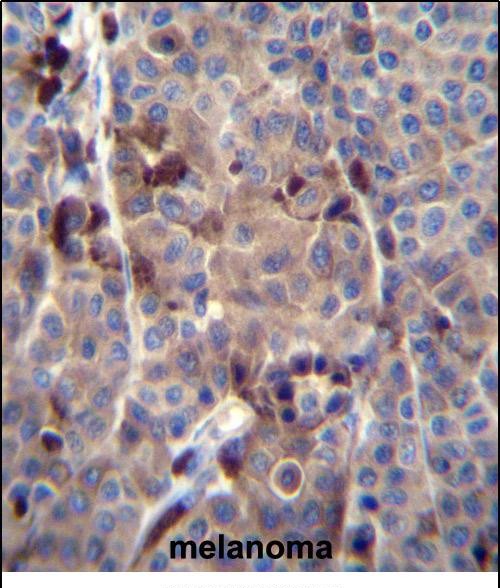 PRAMEF8 Antibody (C-term) western blot analysis in NCI-H460 cell line lysates (35ug/lane).This demonstrates the PRAMEF8 antibody detected the PRAMEF8 protein (arrow).