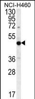 PRAMEF8 Antibody (C-term) western blot analysis in NCI-H460 cell line lysates (35ug/lane).This demonstrates the PRAMEF8 antibody detected the PRAMEF8 protein (arrow).