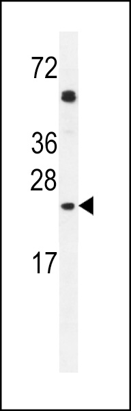 GOLGA2L1 Antibody (C-term) western blot analysis in A549 cell line lysates (35ug/lane).This demonstrates the GOLGA2L1 antibody detected the GOLGA2L1 protein (arrow).