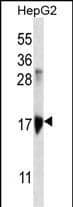 KRTtibody (Center) western blot analysis in HepG2 cell line lysates (35ug/lane).This demonstrates the KRTAP1-3 antibody detected the KRTAP1-3 protein (arrow).