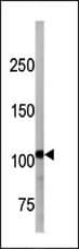 The anti-Phospho-LLGL1/2 Pab is used for detection against A2058 cell line lysate. Phospho-LLGL1/2(arrow) was detected using the purified Pab.