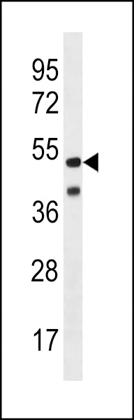 TRX1 Antibody (C-term) western blot analysis in Herpes Simplex X1,Grade 2 lysates (35ug/lane).This demonstrates the TRX1 antibody detected the TRX1 protein (arrow).
