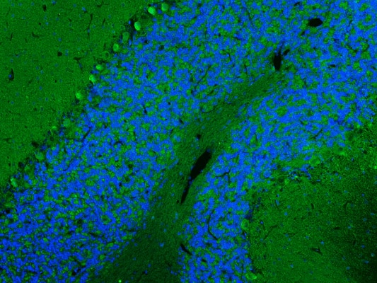 Immunohistochemistry-Paraffin Scn1a Antibody (K74/71) - Chimeric - BSA Free