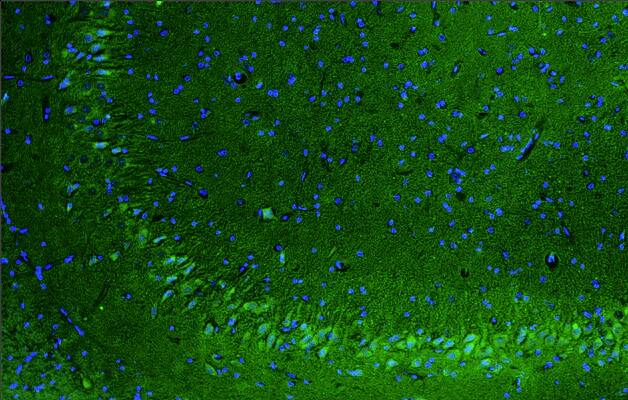 Immunohistochemistry-Paraffin Scn1a Antibody (K74/71) - Chimeric - BSA Free