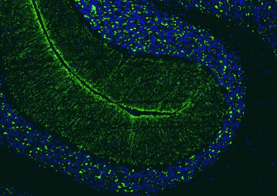 Formalin fixed, paraffin-embedded rat brain cerebellum region showing staining of VGLUT2 with NBP3-52338 at 1:100 dilution. DAPI nuclear stain (blue) shows cell nuclei. NBP3-52338 specifically stains the mossy fiber terminals in the granular layer and climbing climbing fiber terminals in the molecular layer of the cerebellum. Magnification 100X.