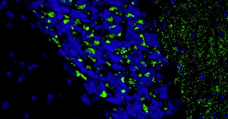 Formalin fixed, paraffin-embedded rat brain cerebellum region showing staining of VGLUT2 with NBP3-52338 at 1:100 dilution. DAPI nuclear stain (blue) shows cell nuclei. This antibody specifically stains the mossy fiber terminals in the granular layer and climbing climbing fiber terminals in the molecular layer of the cerebellum. Magnification 400X.