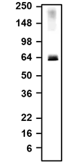 Western blotting of rat brain membrane fraction with NBP3-52338 antibody and detected with anti-chicken-HRP. This antibody recognizes endogenous VGLUT2 in the rat brain membrane fraction at ~60 kDa.