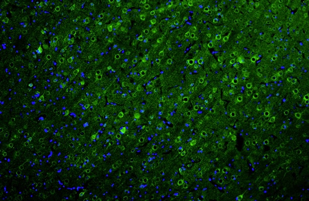 Representative section of formalin fixed, paraffin-embedded rat brain cerebral cortex showing neurons stained by NBP3-52340. DAPI nuclear stain (blue) shows cell nuclei. This antibody specifically stains the neuronal cell body and axon initial segment (AIS) in the cerebral cortex. Magnification 100X.