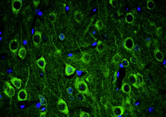 Representative section of formalin fixed, paraffin-embedded rat brain cerebral cortex showing neurons stained by NBP3-52340 (the BSA Free version of this antibody). DAPI nuclear stain (blue) shows cell nuclei. This antibody specifically stains the neuronal cell body and axon initial segment (AIS) in the cerebral cortex. Magnification 400X.