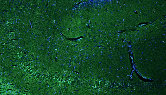 Representative section of formalin fixed, paraffin-embedded rat brain hippocampus region showing cells stained NBP3-52342 using goat anti-chicken IgY secondary antibodyb(green). DAPI nuclear stain (blue) shows cell nuclei. This antibody specifically stains the pyramidal neurons in the CA2 region of the hippocampus.