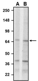 Western blotting of rat brain homogenate with RGS14 mouse monoclonal antibody (A) and NBP3-52342 (B). These antibodies were detected with anti-mouse-HRP and anti-chicken-HRP, respectively. NBP3-52342 recognizes endogenous RGS14 with similar sensitivity as the RGS14 mouse monoclonal antibody in the rat brain homogenate at ~60 kDa