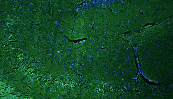 Representative section of formalin fixed, paraffin-embedded rat brain hippocampus region showing cells stained NBP3-52342 (the BSA Free version of this antibody) using goat anti-chicken IgY secondary antibodyb(green). DAPI nuclear stain (blue) shows cell nuclei. This antibody specifically stains the pyramidal neurons in the CA2 region of the hippocampus.