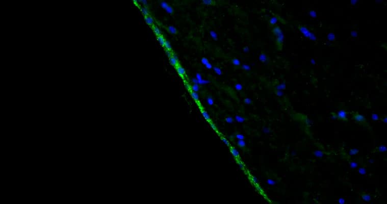 Representative section of formalin fixed, paraffin-embedded rat brain lateral ventricle region showing cells stained by NBP3-52344 (visualized in green) at 1:100 dilution. DAPI nuclear stain (blue) shows cell nuclei. This antibody specifically stains the ciliated cells surrounding the lateral ventricle. Magnification 400X.