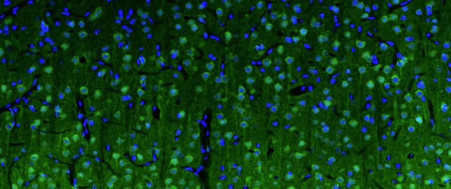 Representative section of formalin fixed, paraffin-embedded rat brain cerebral cortex showing cells stained by NBP3-52346 (visualized in green). DAPI nuclear stain (blue) shows cell nuclei. This antibody specifically stains the neuronal cell body and axon initial segment (AIS) in the cerebral cortex Magnification 100X.