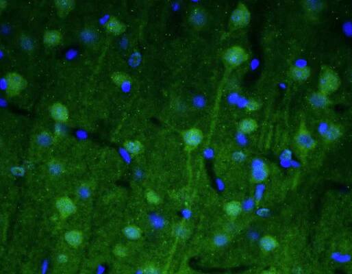Representative section of formalin fixed, paraffin-embedded rat brain cerebral cortex showing cells stained by NBP3-52346 (the BSA Free version of this antibody) (visualized in green). DAPI nuclear stain (blue) shows cell nuclei. This antibody specifically stains the neuronal cell body and axon initial segment (AIS) in the cerebral cortex Magnification 400X.