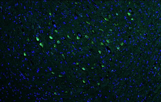 Representative section of formalin fixed, paraffin-embedded rat brain stem showing facial motor neurons stained by NBP3-52348 (the BSA Free version of this antibody) using goat anti-chicken IgY secondary antibody (green). DAPI nuclear stain (blue) shows cell nuclei.