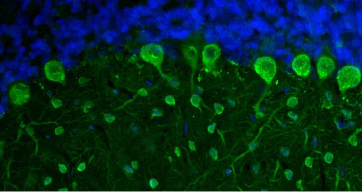 Representative section of formalin fixed, paraffin-embedded rat brain cerebellum region showing staining of Purkinje cells and neurons of the molecular layer with NBP3-52350 (visualized in green) at 1:100 dilution. DAPI nuclear stain (blue) shows cell nuclei. This antibody specifically stains the Purkinje cells and neurons of the molecular layer in the cerebellum. Magnification 400X.