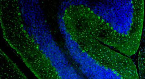 Representative section of formalin fixed, paraffin-embedded rat brain cerebellum region showing staining of Purkinje cells and neurons of the molecular layer with NBP3-52350 (the BSA Free version of this antibody) (visualized in green) at 1:100 dilution. DAPI nuclear stain (blue) shows cell nuclei. This antibody specifically stains the Purkinje cells and neurons of the molecular layer in the cerebellum. Magnification 100X.
