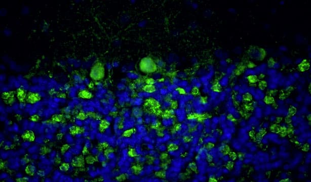 Representative section of formalin fixed, paraffin-embedded rat brain cerebellum region stained with NBP3-52352 at 1:100 dilution. DAPI nuclear stain (blue) shows cell nuclei. This antibody stains the presynaptic sites on Purkinje cell dendrites in the molecular layer of the cerebellum. Magnification 400X.