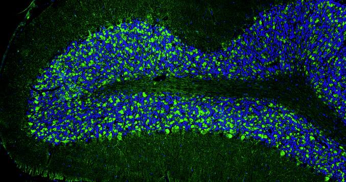Representative section of formalin fixed, paraffin-embedded rat brain cerebellum region stained with NBP3-52352 (the BSA Free version of this antibody) at 1:100 dilution. DAPI nuclear stain (blue) shows cell nuclei. This antibody stains the presynaptic sites on Purkinje cell dendrites in the molecular layer of the cerebellum. Magnification 100X.