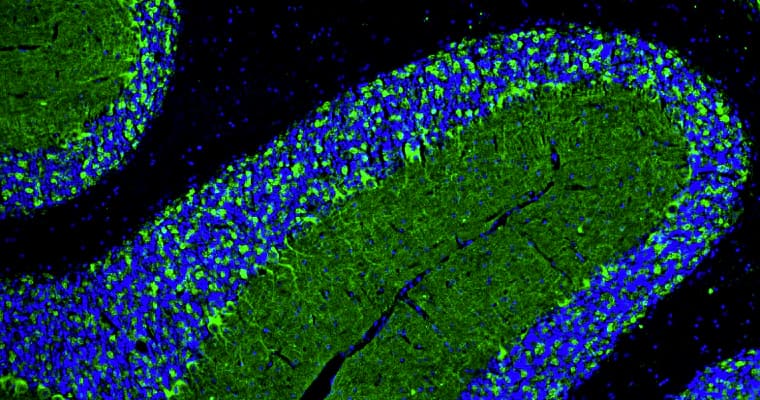Representative section of formalin fixed, paraffin-embedded rat brain cerebellum stained with NBP3-52354 (green) at 1:100 dilution. DAPI (blue) shows cell nuclei. This antibody stains neuropil granules identifying GABAergic synapses, Purkinje cell bodies, and the synaptic terminal of GABAergic interneurons in the molecular layer of the cerebellum. Magnification 100X.