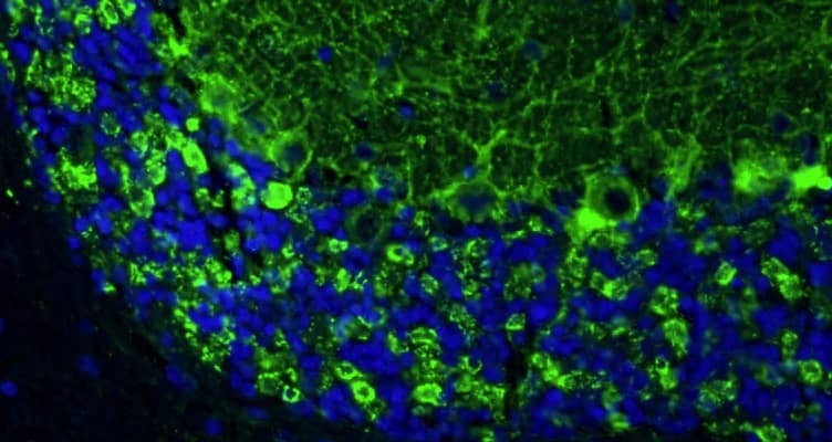 Representative section of formalin fixed, paraffin-embedded rat brain cerebellum stained with NBP3-52354 (green) at 1:100 dilution. DAPI (blue) shows cell nuclei. This antibody stains neuropil granules identifying GABAergic synapses, Purkinje cell bodies, and the synaptic terminal of GABAergic interneurons in the molecular layer of the cerebellum. Magnification 400X.