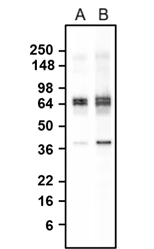Western blotting of rat brain homogenate with GAD65/67 mouse monoclonal antibody (A) and NBP3-52354 (B). The mouse monoclonal antibody and chicken monoclonal antibody were detected with anti-mouse-HRP and anti-chicken-HRP, respectively. The chicken monoclonal antibody recognizes endogenous GAD65/67 with similar sensitivity as the mouse monoclonal antibodyin the rat brain homogenate at ~65-67 kDa.