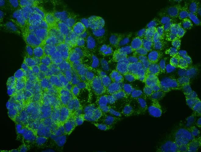 Immunofluorescent staining of HepG2 cells using NBP3-52356 (green). DAPI nuclear stain (blue) shows cell nuclei. This antibody specifically stains the endogenous Human Serum Albumin protein in the cytoplasm of HepG2 cells.