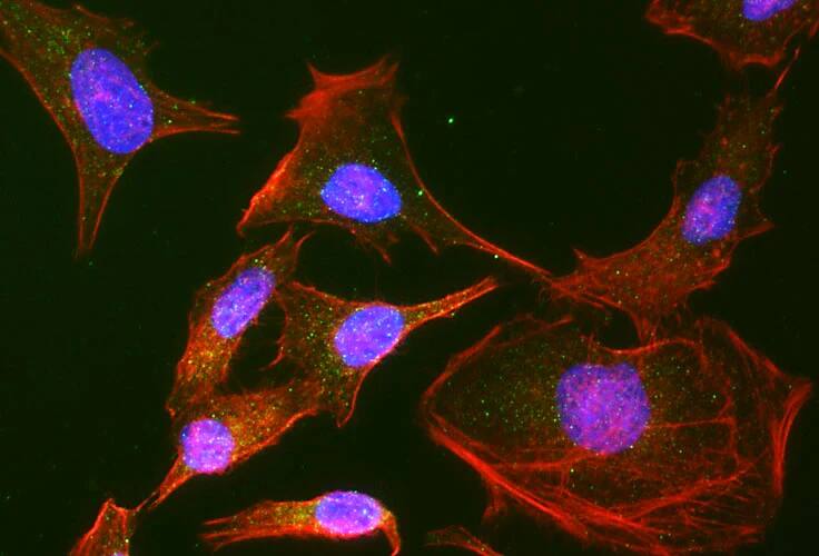 Immunocytochemistry/ Immunofluorescence RAB9A Antibody (Clone 9) - Chimeric - BSA Free