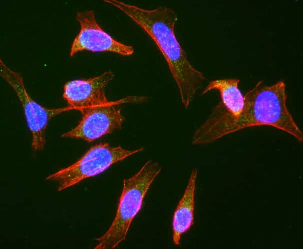 Immunofluorescent staining of HeLa cells using NBP3-52358 (the BSA Free version of this antibody) (green). Actin filaments were stained using Phalloidin (red). DAPI nuclear stain (blue) shows cell nuclei. This antibody specifically stains the late endosomes in HeLa cells.