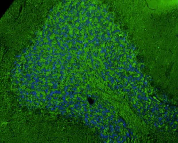Representative section of formalin fixed, paraffin-embedded rat brain cerebellum showing cells stained by NBP3-52360 (green) using goat anti-chicken IgY secondary antibody. DAPI nuclear stain (blue) shows cell nuclei.