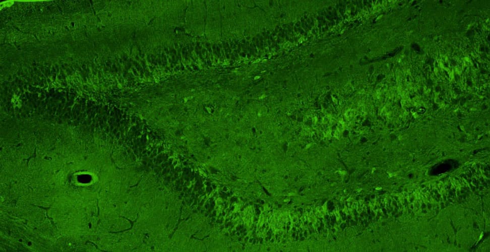 Representative section of formalin fixed, paraffin-embedded rat brain hippocampus showing cells stained by NBP3-52360 (green) using goat anti-chicken IgY secondary antibody.