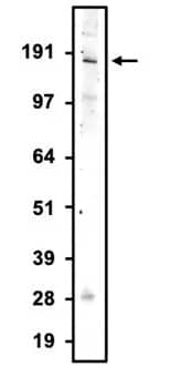 Western blotting of rat brain membrane with NBP3-52360 (the BSA Free version of this antibody). The antibody was detected with anti-chicken-HRP and recognizes endogenous NMDAR2A in the rat brain membrane fraction at ~170 kDa.
