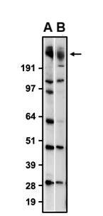 Western blotting of rat brain membrane with ODZ3 mouse monoclonal antibody (A) and with NBP3-52366 (B) recognizing endogenous ODZ3 at ~300 kDa with similar sensitivity. The mouse monoclonal antibody and chicken monoclonal antibody were detected with anti-mouse-HRP and anti-chicken-HRP, respectively.